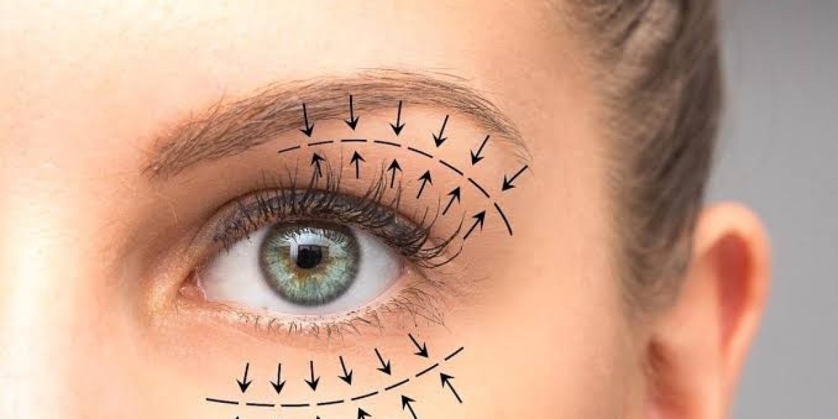 Upper Blepharoplasty in Dubai: Rejuvenate and Refresh Upper Eyelids