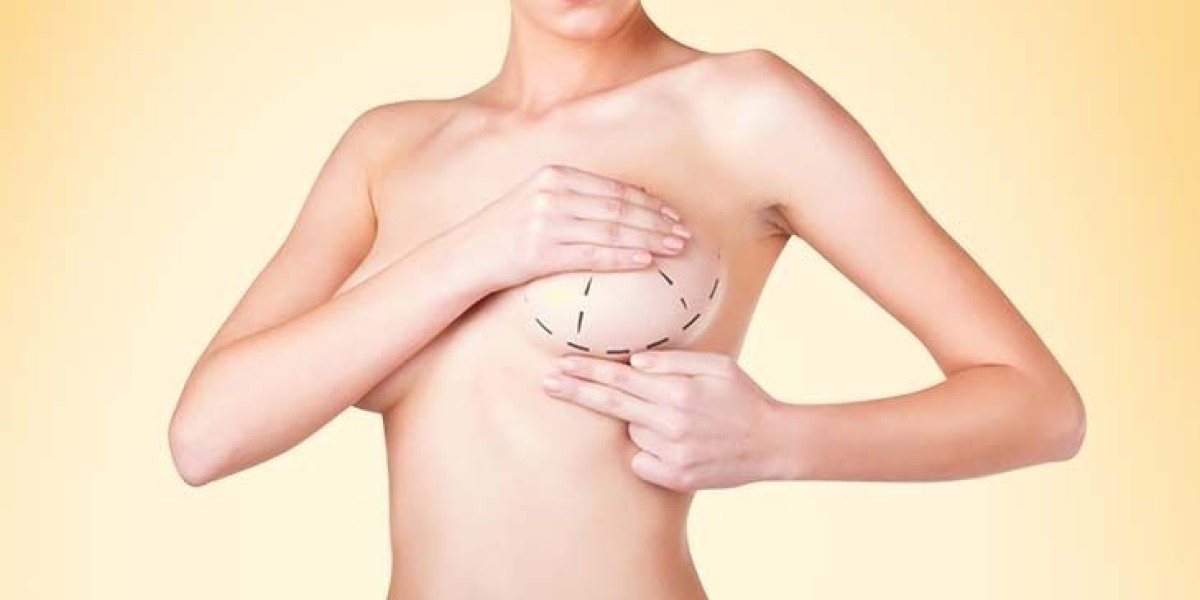 Modern Implant Choices for Breast Augmentation in Dubai