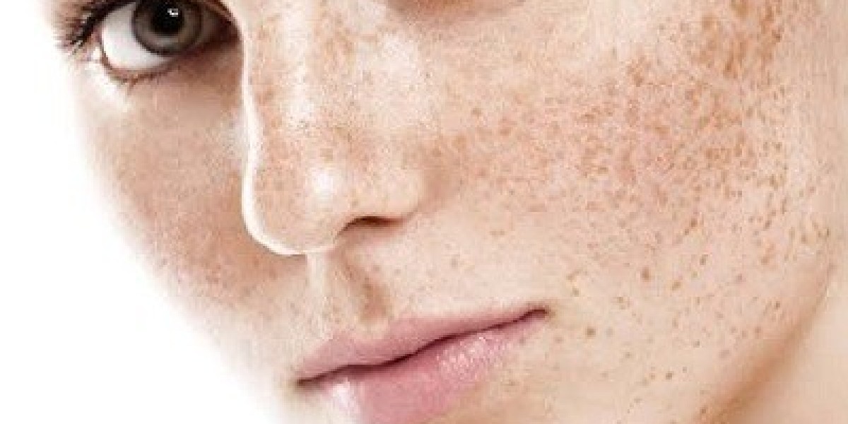 Skin Pigmentation Treatment In Dubai - Evidence-Based Care